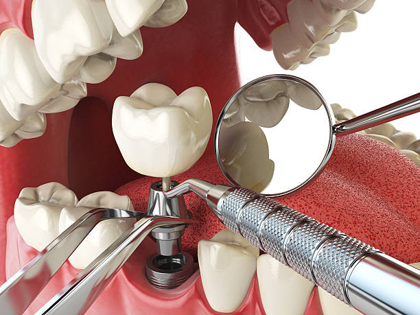 Best Emergency Gum Pain Relief  in Petersburg, IN